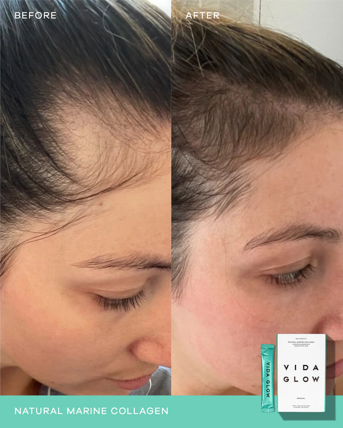 Vida Glow Marine Collagen Original