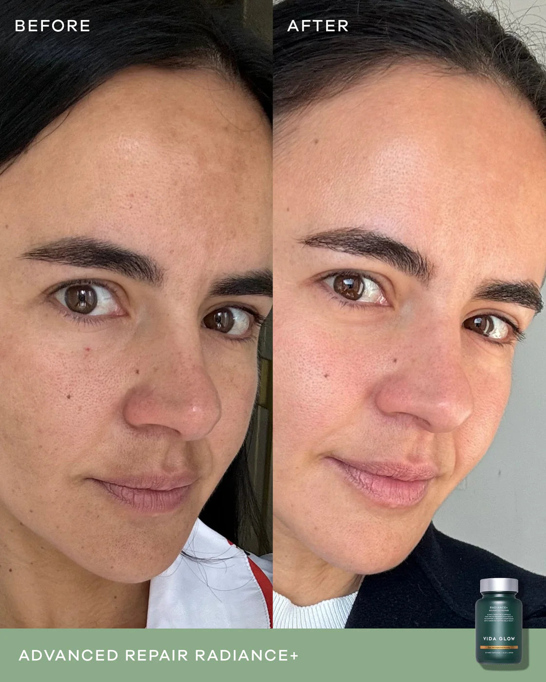 Vida Glow Radiance+